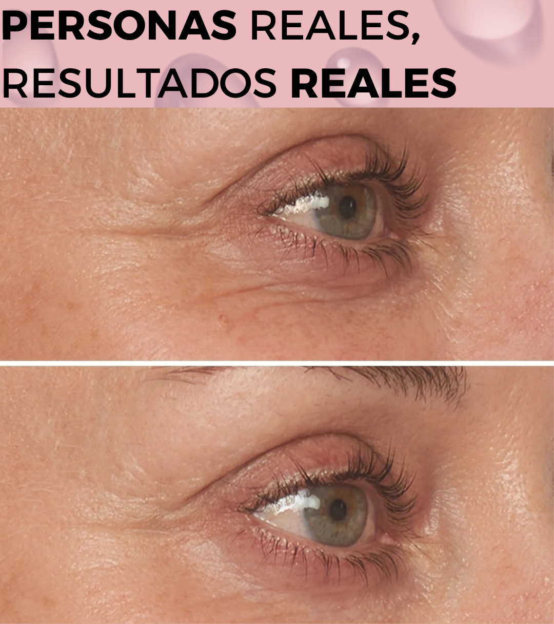 Serum Antiojeras Atrevida®