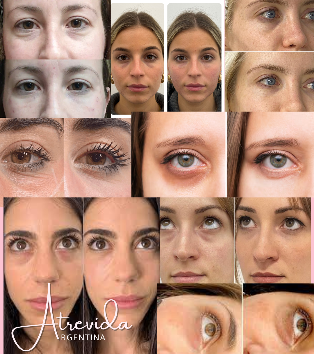 Serum Antiojeras Atrevida®