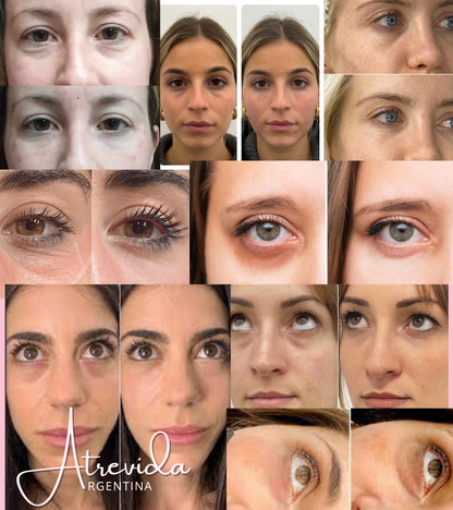 Serum Antiojeras Atrevida®