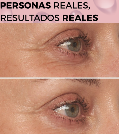 Serum Antiojeras Atrevida®